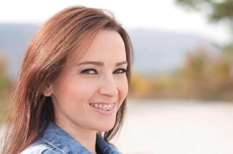 aparat ortodontyczny